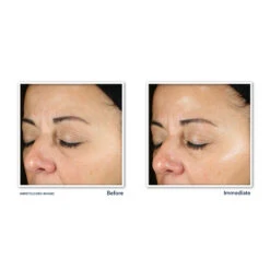 RoC Multi Correxion Daily Serum -Plein Winkel 1021205 3