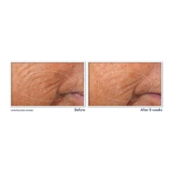 RoC Retinol Correxion Serum Nacht -Plein Winkel 1021217 3