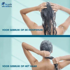 6x Head & Shoulders Conditioner DERMAxPRO -Plein Winkel 1068946 6