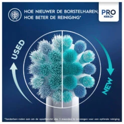 Oral B Oral-B Elektrische Tandenborstel Pro Kids Frozen -Plein Winkel 1072810 6