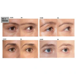 L'Oreal Lu0027Oréal Clinically Proven Wimperserum -Plein Winkel 994623 4